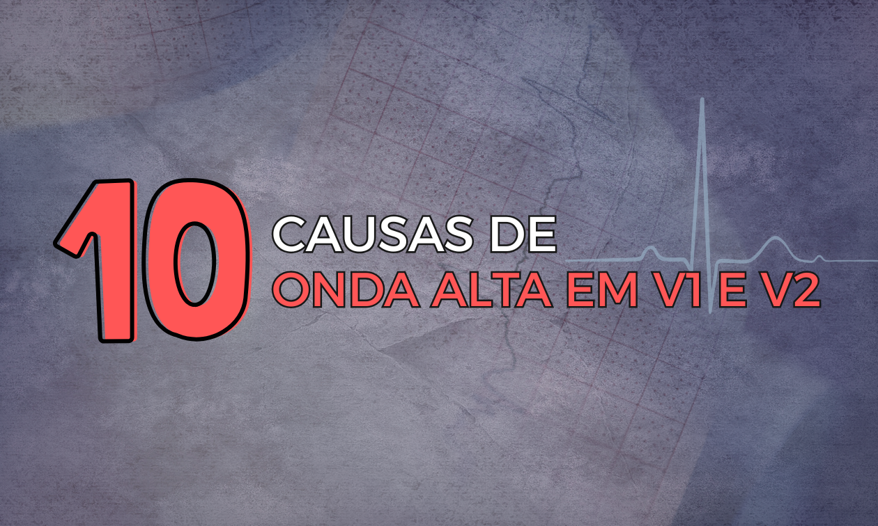 No momento, você está visualizando 10 Causas de Onda R Alta em V1 e V2