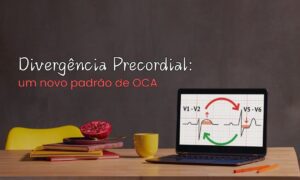 Leia mais sobre o artigo Divergência Precordial: um novo padrão de OCA